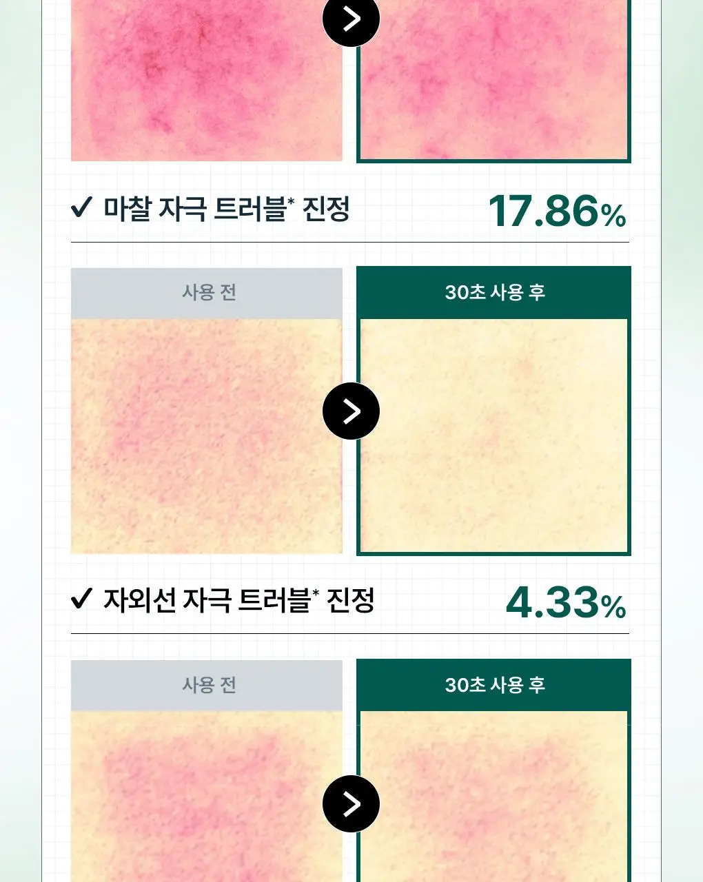 [업그레이드 수분진정세럼] 메디힐 티트리 더마 세럼 50mL 상세페이지 11